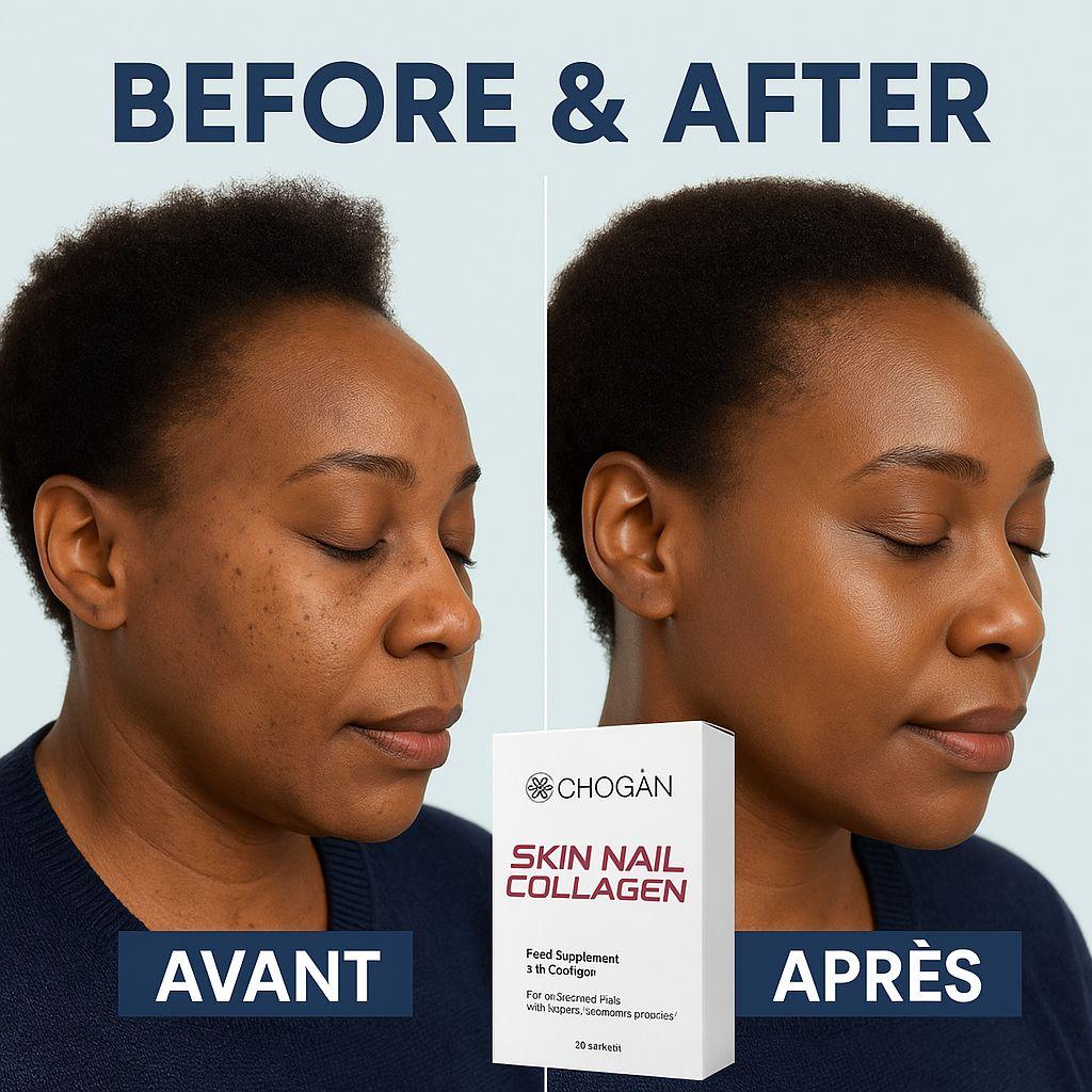 SKINAIL COLLAGEN – Nahrungsergänzungsmittel für Haut, Haare und Nägel
